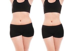 before and after weight loss training sides and abdomen